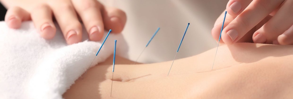 Akupunktura i łagodzenie bólu miesiączkowego