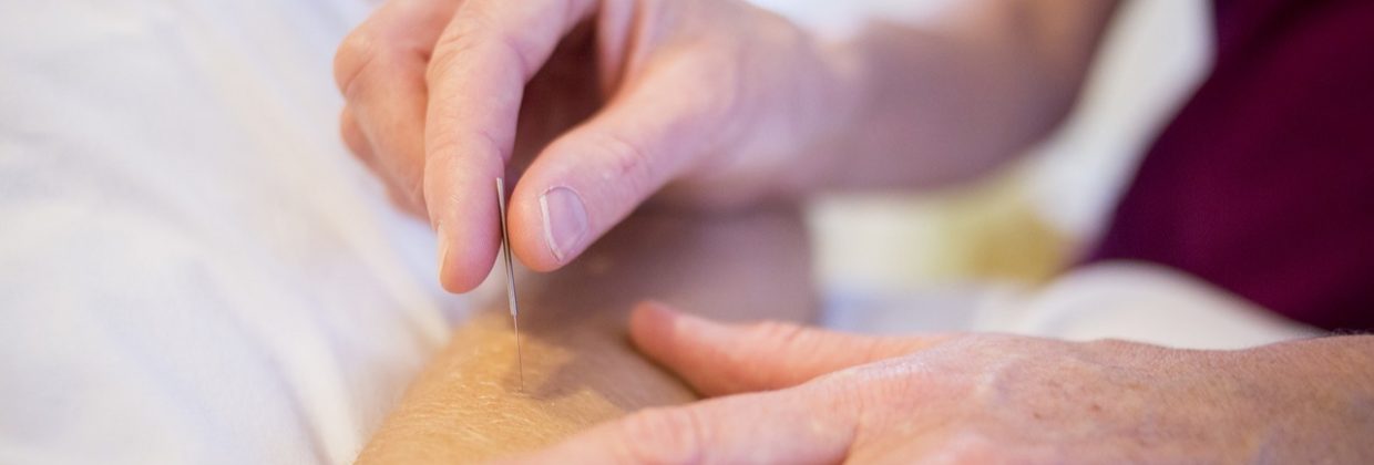 Akupunktura na niepłodność - dlaczego warto zastosować